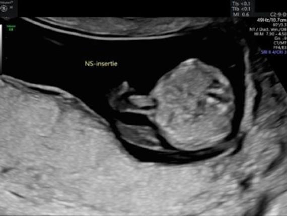 Beoordelingscriteria ETSEO (voorbeeldlogboek) | Prenatale en neonatale